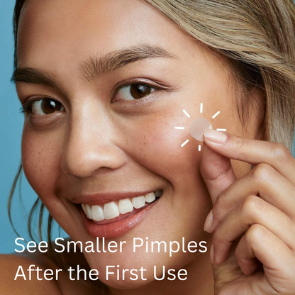 Blemish Away Pimple Patches – Fast, Invisible Acne Care