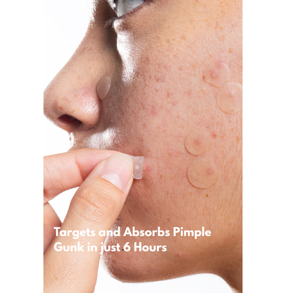Blemish Away Pimple Patches – Fast, Invisible Acne Care
