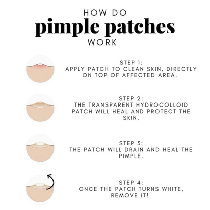 Blemish Away Pimple Patches – Fast, Invisible Acne Care
