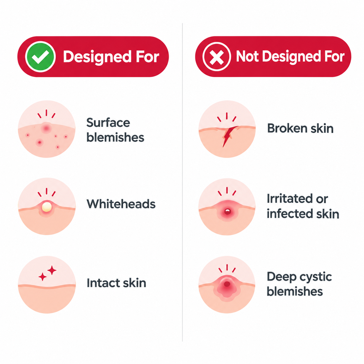 Blemish Away Hydrocolloid Pimple Patches with Tea Tree Oil (72 Count)